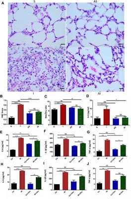 Olmesartan Attenuates Single-Lung Ventilation Induced Lung Injury via Regulating Pulmonary Microbiota